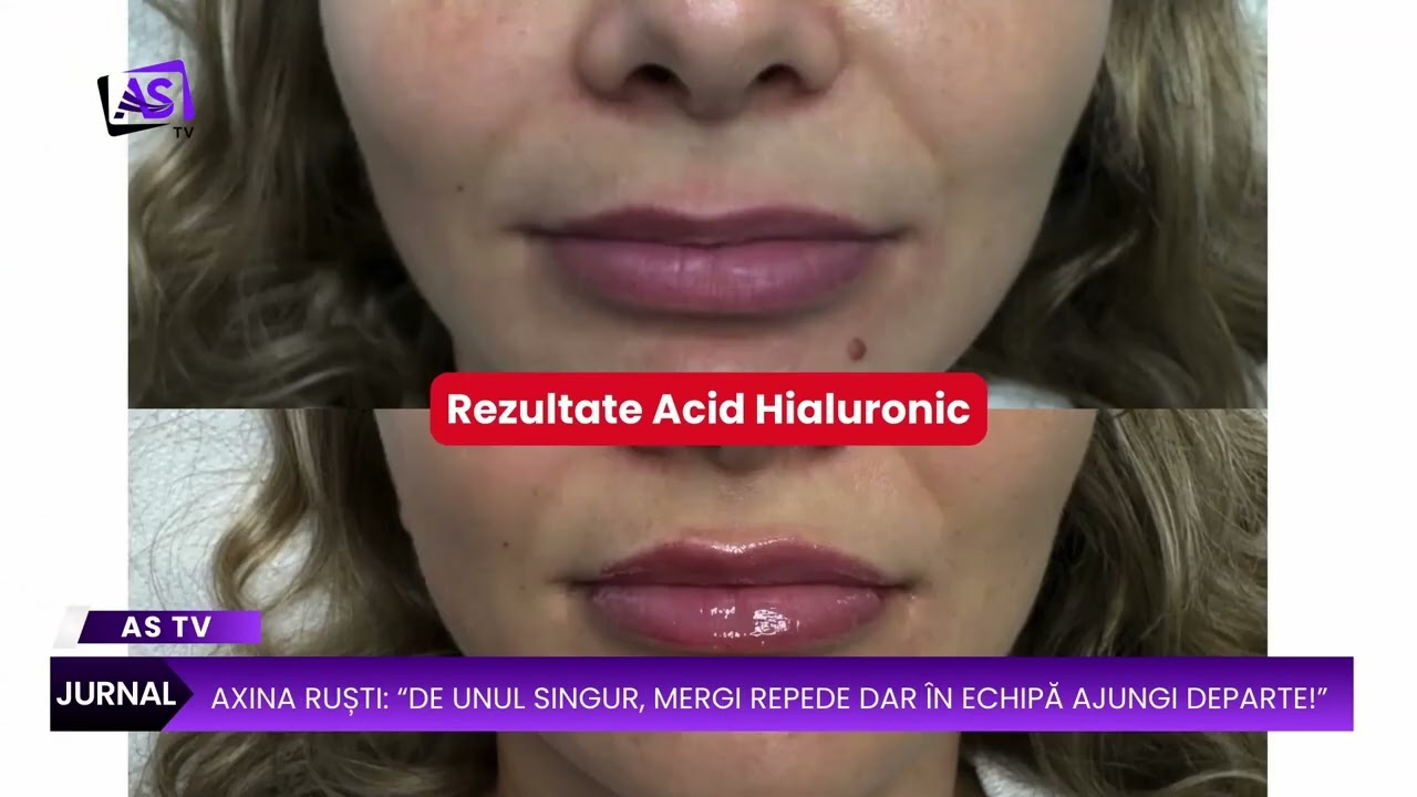 Axina Ruști: “De unul singur, mergi repede dar în echipă ajungi departe!”